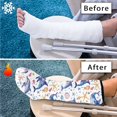 thumbnail image 7 of COEQINE Dolphin Starfish Leg Cast Cover Size M Elastic Cast Socks Cover Cast Short Foot Cast Cover Soft Fabric Leg Plaster Sleeve Decorative Leg Plaster Cover for Kids Girls, 7 of 7