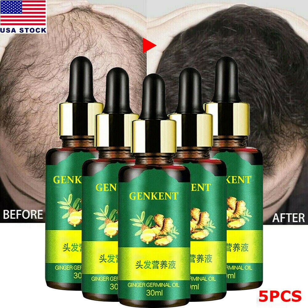 Genkent 5 Pcs Ginger Hair Growth Oil, Hair Regrow Ginger Germinal Essential Oil, Ginger Hair