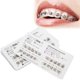 thumbnail image 3 of Suministros de ortodoncia, soportes de ortodoncia dental, aparatos ortopédicos, herramienta de ortodoncia dental, suministros de ortodoncia dental, durabilidad mejorada, 3 of 8