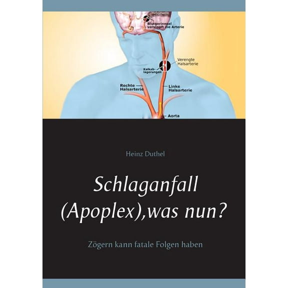 Schlaganfall (Apoplex), was nun?: Zögern kann fatale Folgen haben, (Paperback)