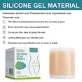 thumbnail image 3 of Silicone Scar Sheets, Silicone Easy-tear Gel Tape Roll, 3 of 5