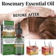 thumbnail image 2 of 3x EELHOE Hair Oil For Dry Scalp Stimulates Hair Growth Hair Care Essential Oil Refreshing Firming Skin Rosemary Oil, 2 of 5