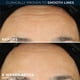 thumbnail image 4 of Sérum de noche RoC Retinol Correxion antiarrugas antiedad 30 mL RoC RoC, 4 of 8