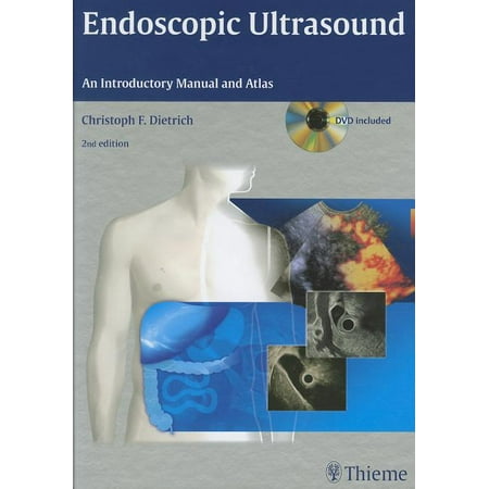 UPC: 9783131431523 | Endoscopic Ultrasound: An Introductory Manual and Atlas (Hardcover)
