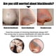 thumbnail image 3 of Black Pig Nose Bamboo Charcoal Patches Comedo Removal Nose Mask Tear Off Nose Pore Cleaning Stickers, 3 of 5