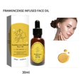 thumbnail image 4 of Improve Dark Yellow Moisturizing And Skin Frankincense Oil 30ml, 4 of 9