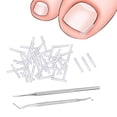 thumbnail image 3 of 50 Pieces Ingrown Toenail Corrector Strips Curved Toenail Corrector Toenail Correction Tool Comfortable Toenail Straightener Strip SPA, 3 of 8