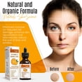 thumbnail image 6 of Dermaxgen® PURE ORGANIC Vitamin C 20% + Retinol + Hyaluronic Acid ANTI-AGING SERUM - 4 FL OZ, 6 of 9
