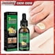 thumbnail image 2 of Jaysuing Ginger Nail Care Solution 30ml Nail Fungus Repair Hand, Foot Nail Care Soft Nail Bright -, 2 of 4