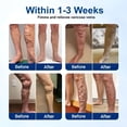 thumbnail image 7 of QARUN Microdarts Patch,Vein Target Patch,Relieve Leg Discomfort,Soothes Leg Discomfort,Effectively Moisturizes (1Pc), 7 of 7