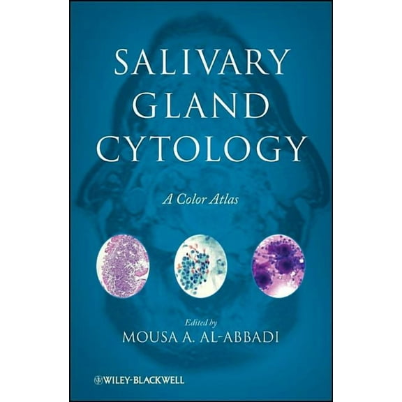 Salivary Gland Cytology: A Color Atlas, (Hardcover)