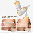 thumbnail image 4 of ‌Glycolic Acid Toner Gently Exfoliating Clearer Skin 240ml, 4 of 7