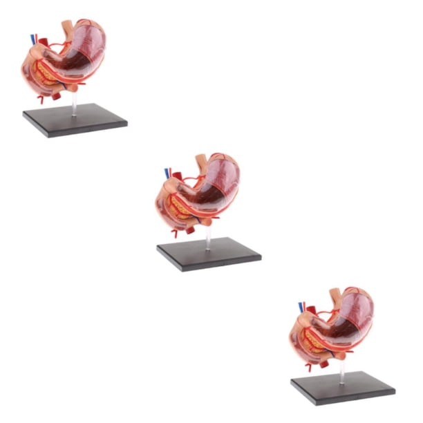 Vogacara 2:3 Human Human Stomach Pancreas with Model Study Internal Organs Anatomy Type1 NO1