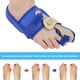 thumbnail image 4 of Corrector de hallux valgus, 1 par de separadores de hallux valgus para dedos de los pies femeninos, corrector de juanetes, características de vanguardia, 4 of 8