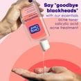 thumbnail image 3 of Clean & Clear Essentials Oil-Free Acne Toner, Salicylic Acid, 8 fl. oz, 3 of 8