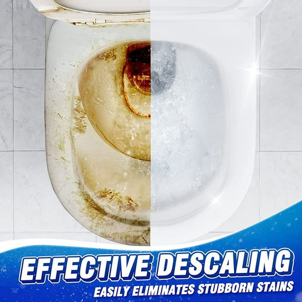 Acheter Sagit – nettoyeur de cuvette de toilette automatique, 16 pièces,  nettoyant de réservoir, comprimés, nettoyant de chasse d'eau, déodorant,  outil de nettoyage de comprimés
