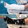 thumbnail image 7 of COEQINE Galaxy Planet Leg Cast Covers 2 Piece Kids Leg Cast Cover Sock Knee Cast Sock Easy to Put on Leg Cast Cover for Swimming Cast Scratcher Sleeve for Kids Girls Size L, 7 of 7