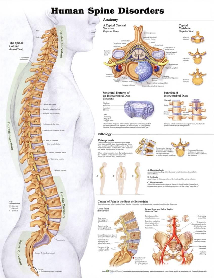 Human Spine Disorders Anatomical Chart Poster Print Poster - 20x26