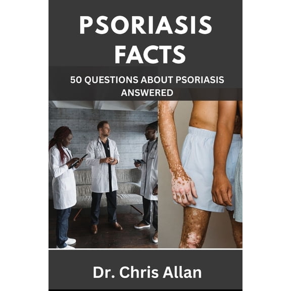 Psoriasis Facts: 50 Questions about Psoriasis Answered., (Paperback)