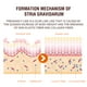 thumbnail image 3 of Eliminación de estrías Spray Estrías Arrugas del vientre Grasa Estrías Hidratante Eliminación 30ml Mascara Remover para ojos sensibles kaili Sencillez, 3 of 5