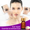 thumbnail image 2 of Wekity 3PCS Lavender Skin Essential Oil ST-001, 2 of 7