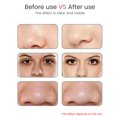 thumbnail image 4 of Blackhead Remover Beauty Machine 3 Gears Ajustable Pore Acne Remover Labymos Removedor de espinillas, 4 of 7