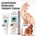 thumbnail image 2 of 3pcs Acanthosis Cream Nigrifix Cream For Acanthosis Nigricans Black Spot, 2 of 5