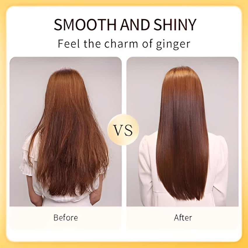 ABBASI & CO Anti-Hair Loss Shampoo & Conditioner Set - Ginger Plant Extract Instant Hair Growth Shampoo - Anti-Dandruff Care Formula - Oil Control & Hair Loss Treatments For women & Men - 2x 800 ML