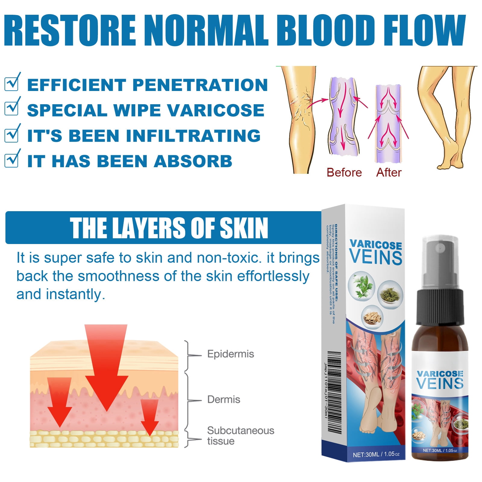 Alvantor Body Spray for Veins Leg Treatment with Herbal Formula, Relieves Tired Heavy Legs, 1.05oz