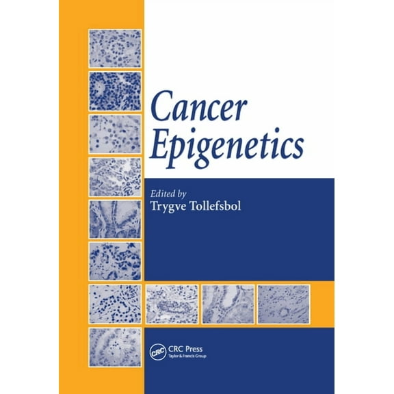 Cancer Epigenetics, (Paperback)