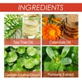 thumbnail image 6 of Acne patch Skin cleansing acne blackheads acne blackheads care skin tag patch, 6 of 6