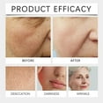 thumbnail image 4 of Retinol Crema Facial Anti Edad Hidratante con Ingredientes Naturales para la Reducción de Arrugas Estiramiento y Alisado de la Piel Tratamiento Facial Diario para Todo Tipo de Pieles con, 4 of 5
