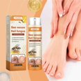thumbnail image 2 of 1-3x Fungals Treatments Spray for Toenail Fingernail Super Strength Antifungals Liquid for All Nail Type, 2 of 5