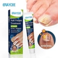 thumbnail image 1 of Nourishing Nail Repair Cream for Discolored and Damaged Nails, 20g Anti-Fungal Treatment, 1 of 4