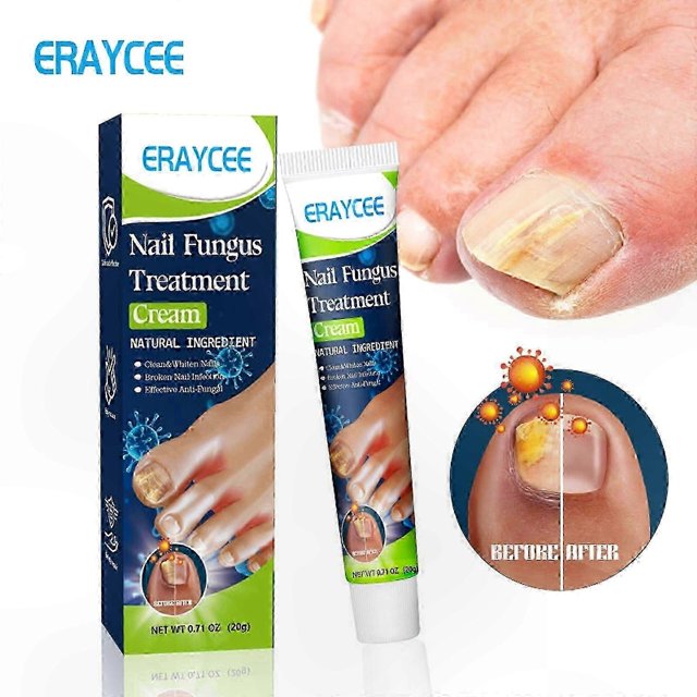 Nourishing Nail Repair Cream for Discolored and Damaged Nails, 20g Anti-Fungal Treatment