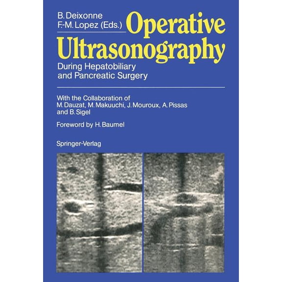 Operative Ultrasonography: During Hepatobiliary and Pancreatic Surgery, (Paperback)