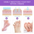 thumbnail image 4 of Milk Foot Peel Mask by - Feet Peeling Mask for Repair Rough Heels and Remove Dead Skin & Callus, Enjoy Baby-soft and Smooth Feet, Exfoliating Foot Mask for Dry Cracked Feet - 5 Pack, 4 of 8