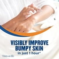 thumbnail image 4 of Gold Bond Ultimate Rough And Bumpy Skin Cream - 8 Oz, 3 Pack, 4 of 6