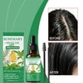 thumbnail image 5 of Mint Oil Reduces Sebum Production Improves Oily Scalp Enhances Scalp Health Nourishes And Strengthens Nails 60ml, 5 of 8