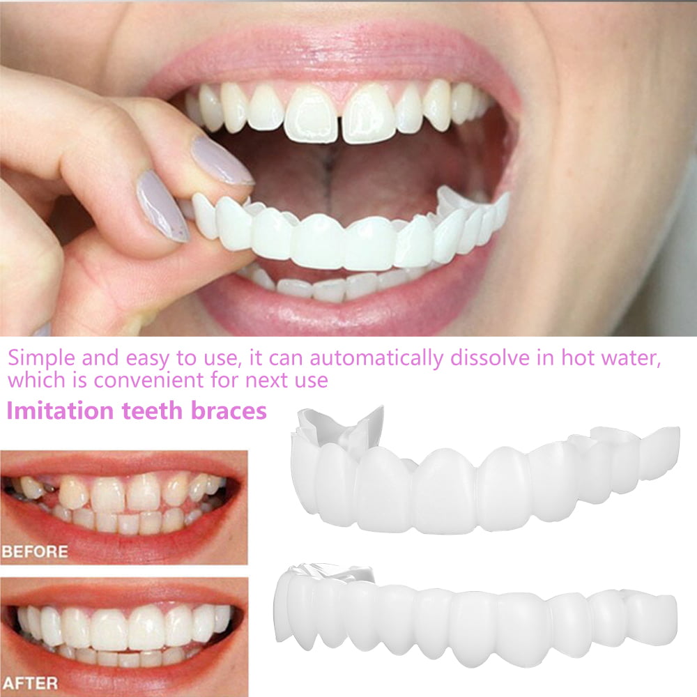 Disipar los padres de crianza experimental HOTBEST Smile Veneers Snap On Upper False Teeth Dental Veneers Dentures  Tooth Cover White Teaching and Temporary Braces Cover Instant and Improve  Smile - Walmart.com