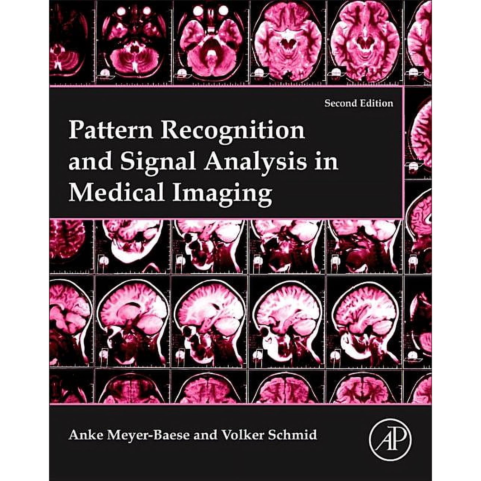 Pattern Recognition and Signal Analysis in Medical Imaging (Paperback)