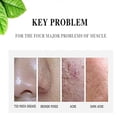 thumbnail image 3 of AICHUN BEAUTY Face Acne Cleaning Cream Skin Care Remove Repair Comedone Pimple Acne Face Acne Cream, 3 of 9