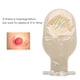 thumbnail image 4 of Bolsa de colostomía Bolsa de ostomía Cubierta de ostomía Bolsa drenable Suministros de ostomía Paquete de 10 piezas  de una pieza Bolsa de ostomía Bolsa médica drenable Bolsa ANGGREK Otros, 4 of 7