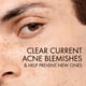 thumbnail image 2 of Gel de lavado facial VICHY Normaderm Daily Acne con ácido salicílico al 0,5%, 2 of 7