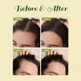 thumbnail image 4 of Aceite para el crecimiento del cabello FEIBTH Veganic Natural para hombres y mujeres, 4 of 7