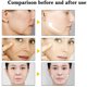 thumbnail image 4 of Suero facial eliminador de arrugas Esencia antienvejecimiento Hidratante Iluminador Nutritivo Atenúa líneas finas Reparador Reafirmante facial Cuidado de la piel, 4 of 6