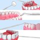thumbnail image 3 of 8-piece Set Dental Care Set,stainless Steel Dentist Instrument,dental Tools, 3 of 5