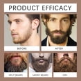 thumbnail image 3 of Limpiador de barba para hombres | Fórmula suave y nutritiva para un cuidado suave y liso de la barba | Limpieza profunda e hidratación | Reduce el frizz y las puntas abiertas | Comodidad para, 3 of 7