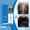 thumbnail image 3 of Sérum Capillaire Rouleau à Billes Roulantes à Base de Plantes Sérum Réactif pour Cheveux Naturels pour Cheveux Plus Épais pour Cheveux Recalés 10ml, 3 of 9