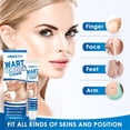 thumbnail image 5 of Wart Remover Paste,Fast-Acting Wart Paste And Paste For All Types Of Warts, Lotion Wart Set,Easy Application, 5 of 5